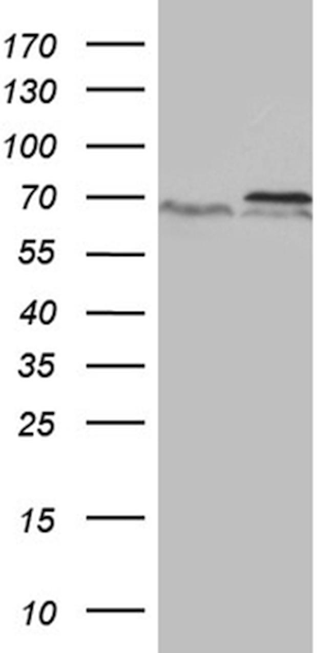 PRMT5 Antibody in Western Blot (WB)