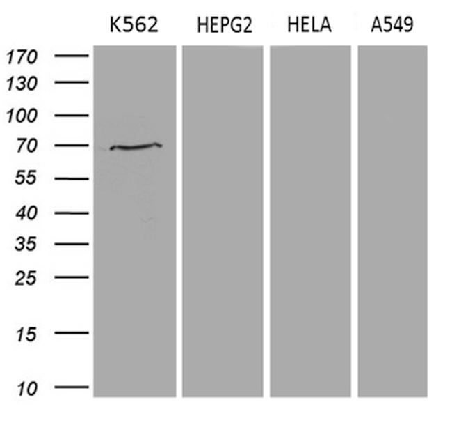 PRMT5 Antibody in Western Blot (WB)