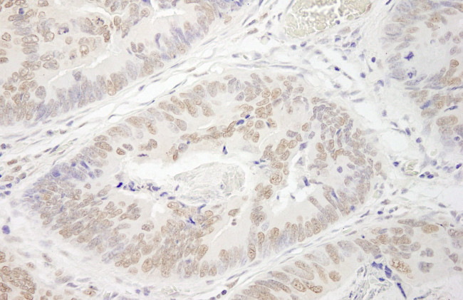 PRMT6 Antibody in Immunohistochemistry (IHC)