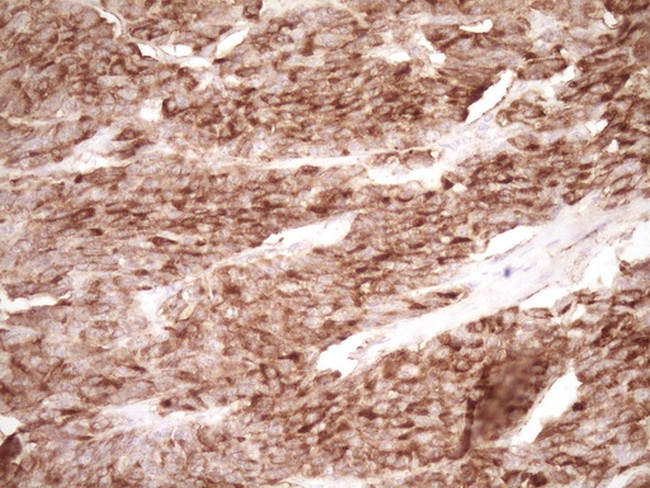 PROCR Antibody in Immunohistochemistry (Paraffin) (IHC (P))