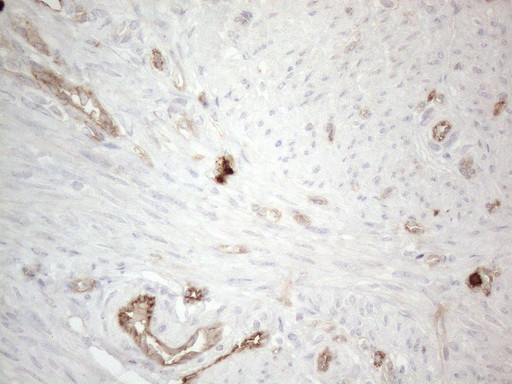 PROCR Antibody in Immunohistochemistry (Paraffin) (IHC (P))