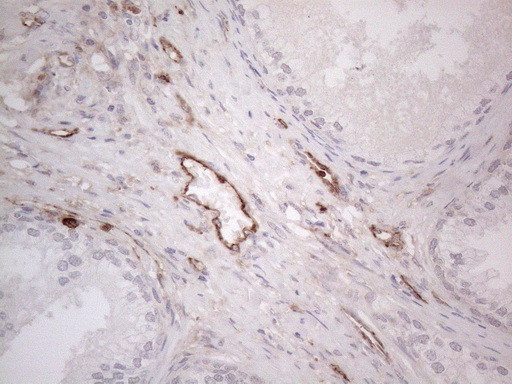 PROCR Antibody in Immunohistochemistry (Paraffin) (IHC (P))