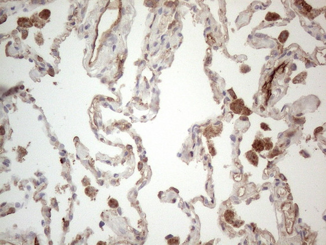 PROCR Antibody in Immunohistochemistry (Paraffin) (IHC (P))