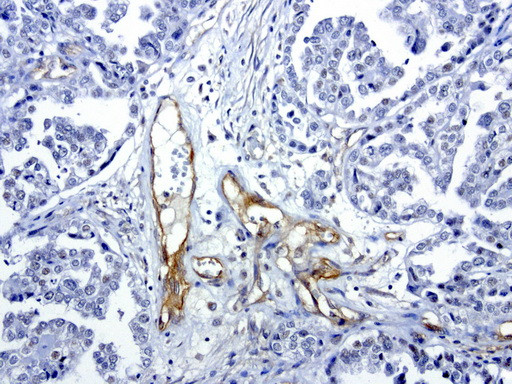 PROCR Antibody in Immunohistochemistry (Paraffin) (IHC (P))