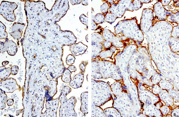 PROCR Antibody in Immunohistochemistry (Paraffin) (IHC (P))