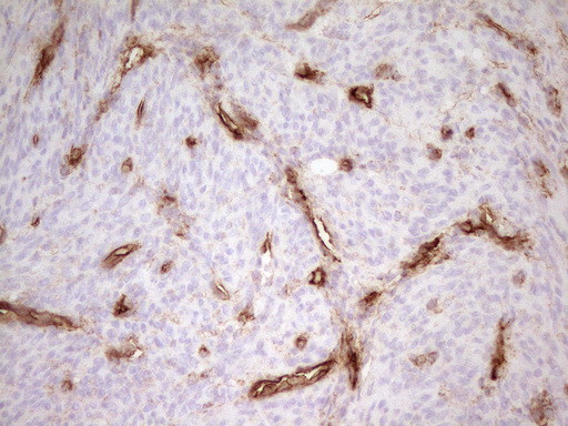 PROCR Antibody in Immunohistochemistry (Paraffin) (IHC (P))