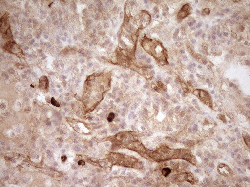 PROCR Antibody in Immunohistochemistry (Paraffin) (IHC (P))