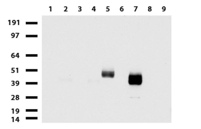 PROCR Antibody in Western Blot (WB)
