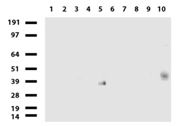 PROCR Antibody in Western Blot (WB)