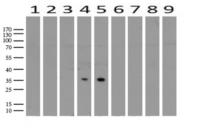 PROCR Antibody in Western Blot (WB)