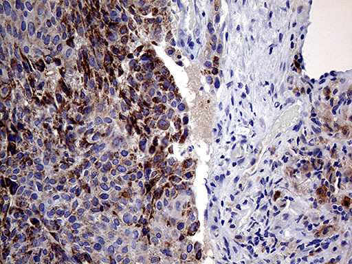 PRODH Antibody in Immunohistochemistry (Paraffin) (IHC (P))