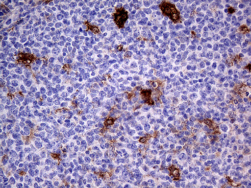 PRODH Antibody in Immunohistochemistry (Paraffin) (IHC (P))