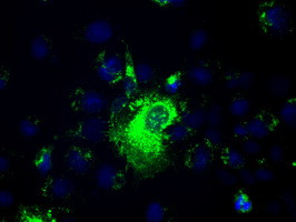 PROM2 Antibody in Immunocytochemistry (ICC/IF)