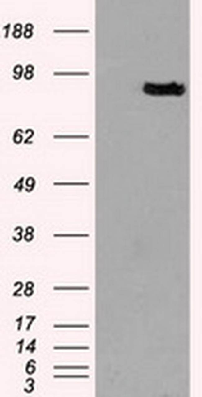 PROM2 Antibody in Western Blot (WB)