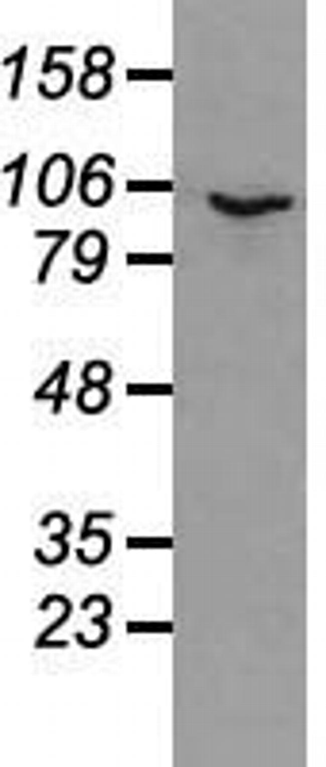 PROM2 Antibody in Western Blot (WB)