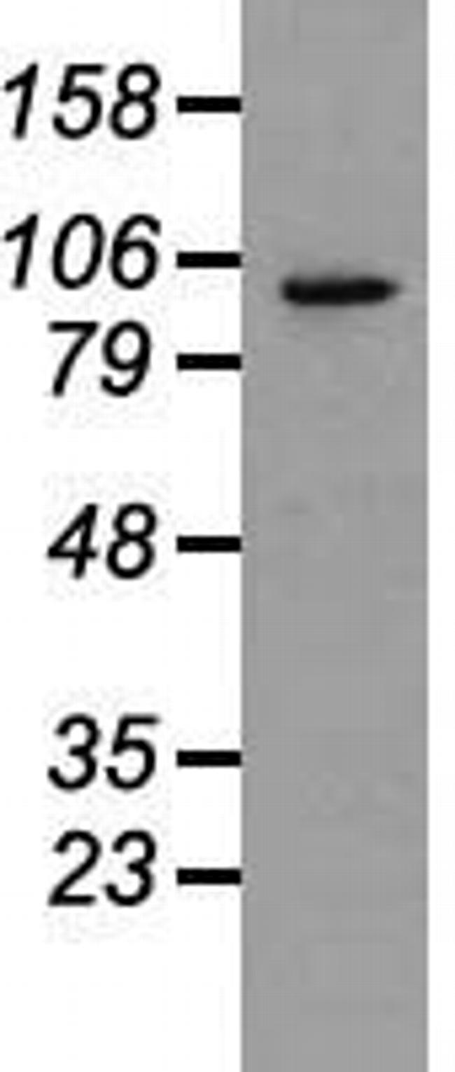 PROM2 Antibody in Western Blot (WB)