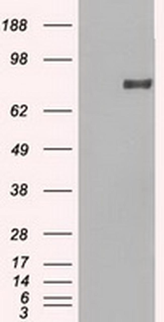 PROM2 Antibody in Western Blot (WB)