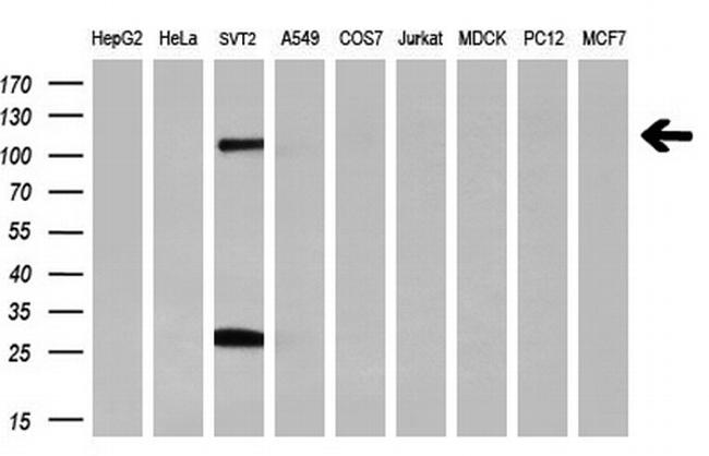 PROM2 Antibody in Western Blot (WB)