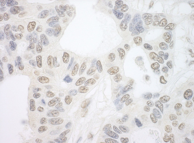 PRP6 Antibody in Immunohistochemistry (IHC)