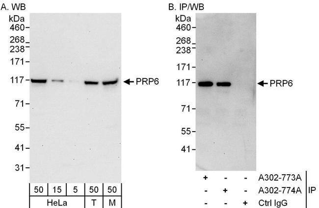 PRP6 Antibody in Western Blot (WB)