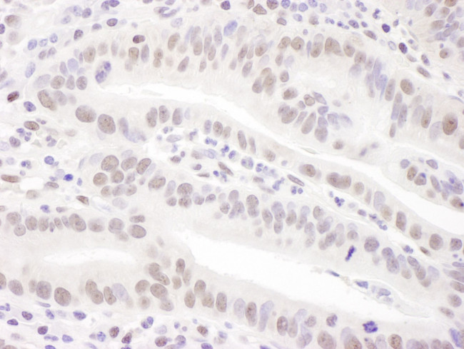 PRPF31 Antibody in Immunohistochemistry (IHC)