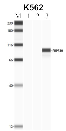 PRPF39 Antibody in Immunoprecipitation (IP)