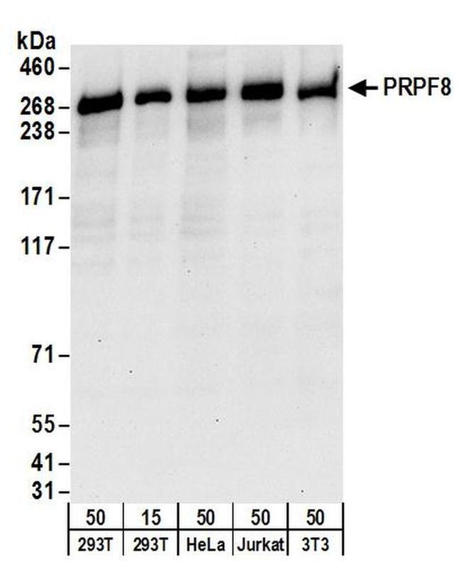 PRPF8 Antibody in Western Blot (WB)