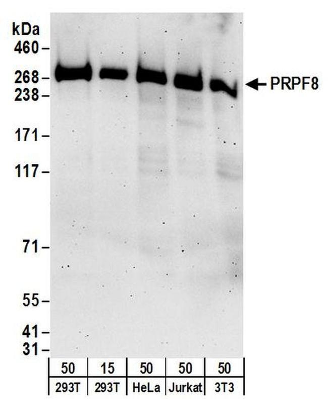 PRPF8 Antibody in Western Blot (WB)