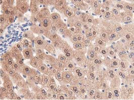 PRPSAP2 Antibody in Immunohistochemistry (Paraffin) (IHC (P))