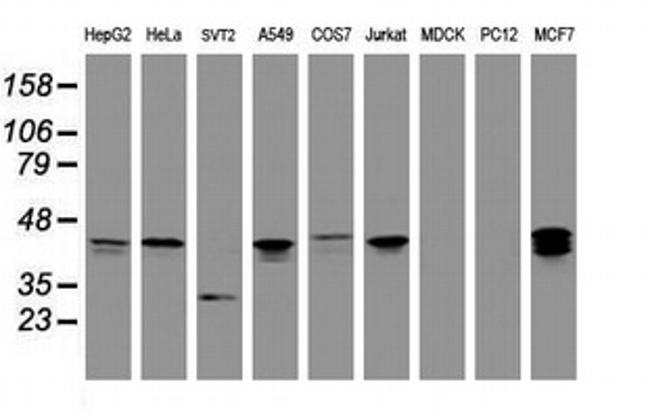 PRR11 Antibody in Western Blot (WB)