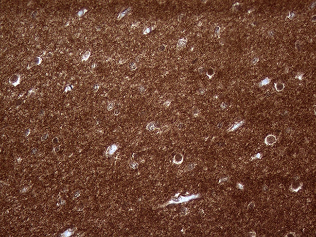 PRRT2 Antibody in Immunohistochemistry (Paraffin) (IHC (P))