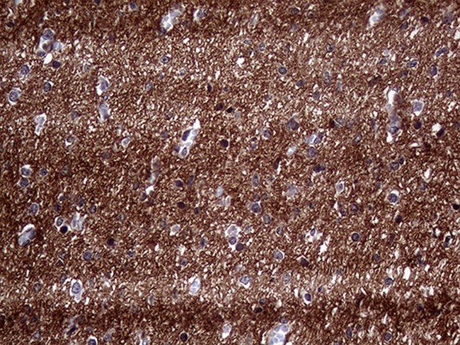 PRRT2 Antibody in Immunohistochemistry (Paraffin) (IHC (P))