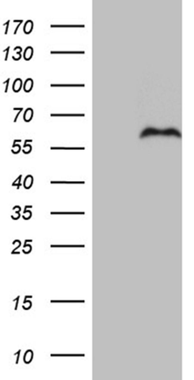 PRRT2 Antibody in Western Blot (WB)