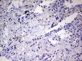 PRRX1 Antibody in Immunohistochemistry (Paraffin) (IHC (P))