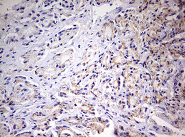 PRRX1 Antibody in Immunohistochemistry (Paraffin) (IHC (P))