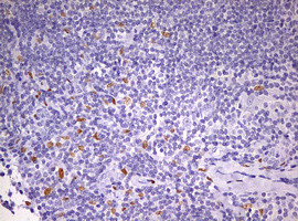 PRRX1 Antibody in Immunohistochemistry (Paraffin) (IHC (P))