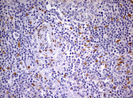 PRRX1 Antibody in Immunohistochemistry (Paraffin) (IHC (P))