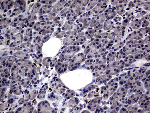 PRRX1 Antibody in Immunohistochemistry (Paraffin) (IHC (P))