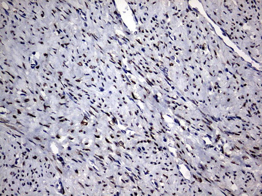 PRRX1 Antibody in Immunohistochemistry (Paraffin) (IHC (P))