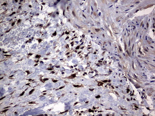 PRRX1 Antibody in Immunohistochemistry (Paraffin) (IHC (P))