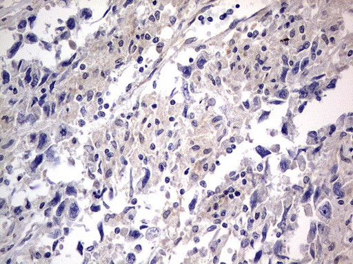 PRRX1 Antibody in Immunohistochemistry (Paraffin) (IHC (P))