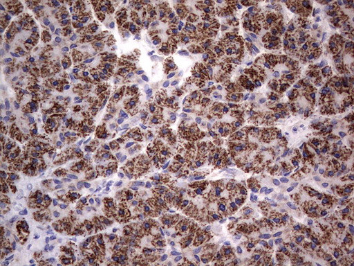 PRRX1 Antibody in Immunohistochemistry (Paraffin) (IHC (P))