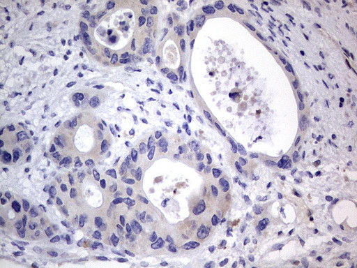 PRRX1 Antibody in Immunohistochemistry (Paraffin) (IHC (P))