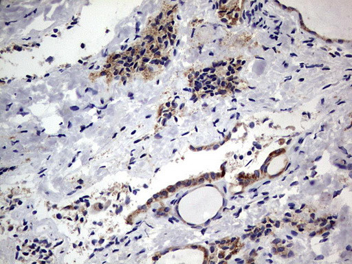 PRRX1 Antibody in Immunohistochemistry (Paraffin) (IHC (P))