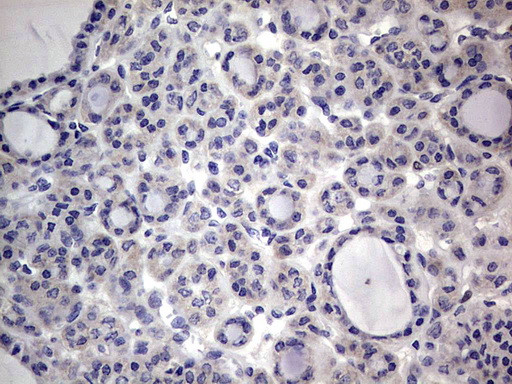 PRRX1 Antibody in Immunohistochemistry (Paraffin) (IHC (P))