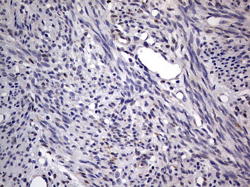 PRRX1 Antibody in Immunohistochemistry (Paraffin) (IHC (P))