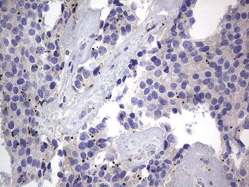 PRRX1 Antibody in Immunohistochemistry (Paraffin) (IHC (P))