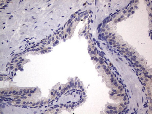 PRRX1 Antibody in Immunohistochemistry (Paraffin) (IHC (P))