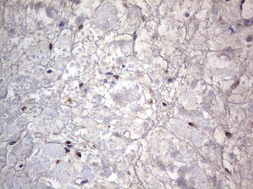 PRRX1 Antibody in Immunohistochemistry (Paraffin) (IHC (P))