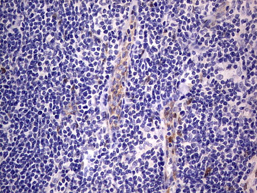 PRRX1 Antibody in Immunohistochemistry (Paraffin) (IHC (P))